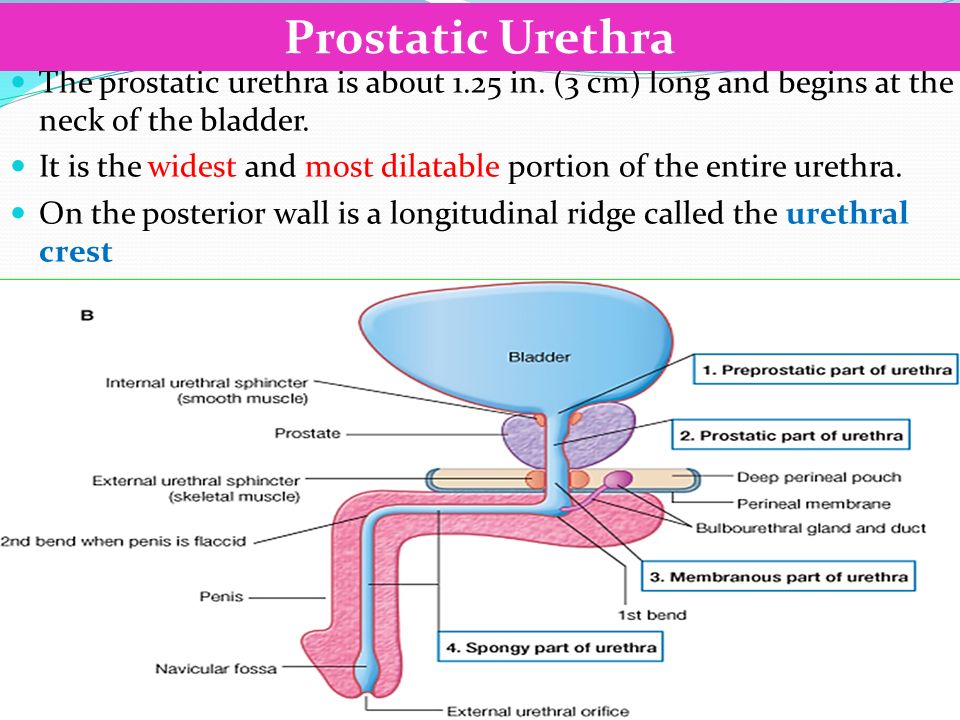 What causes prostate calcification